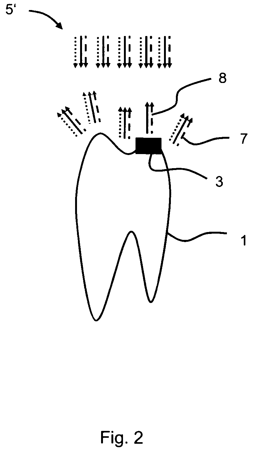 Method for identifying tooth-colored tooth filling residues