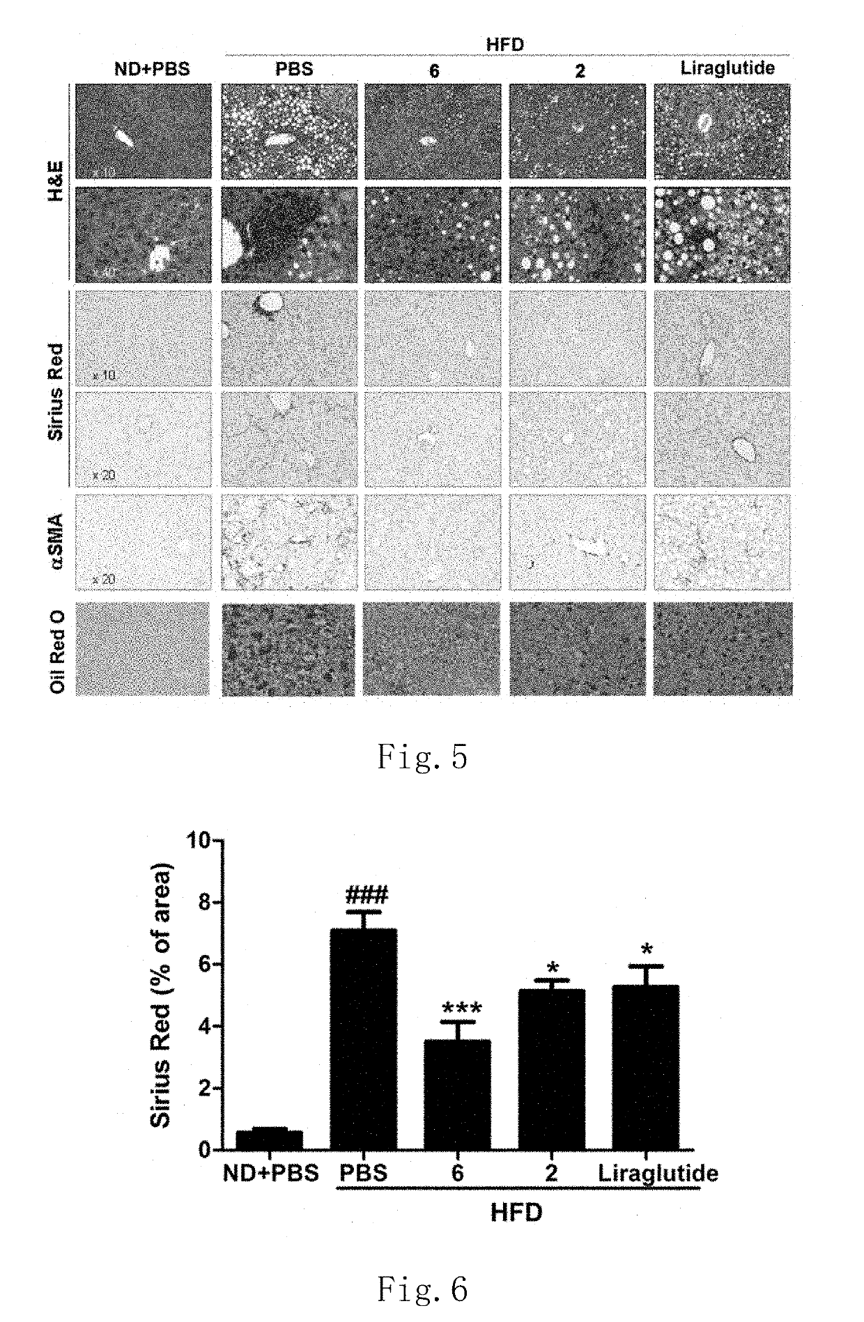 Glp-1r/gcgr dual target agonist polypeptide for treatment of fatty liver diseases, hyperlipemia and arteriosclerosis