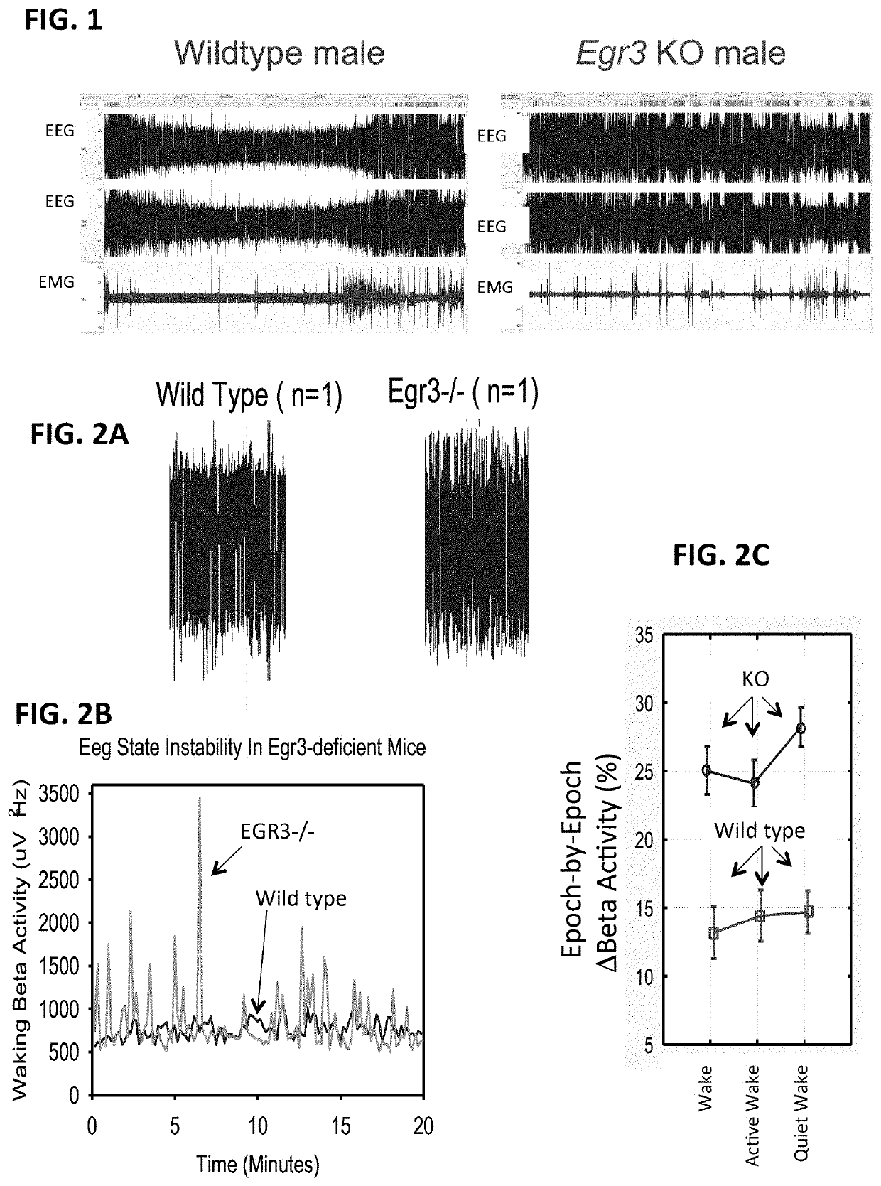 Methods and systems for detecting psychotic disorders associated with serotonin receptor deficiencies