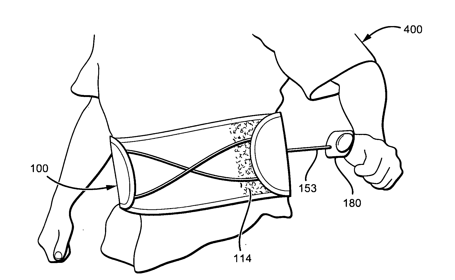 Highly Adjustable Lumbar Support And Methods