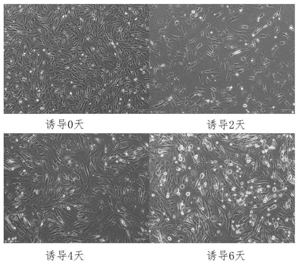 High-purity duck intramuscular precursor fat cell separation method