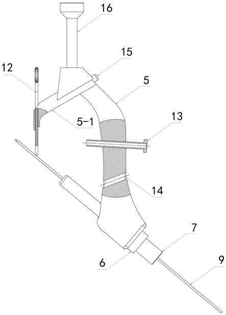 Implanting device for femoral intertrochanteric fracture conformal nail