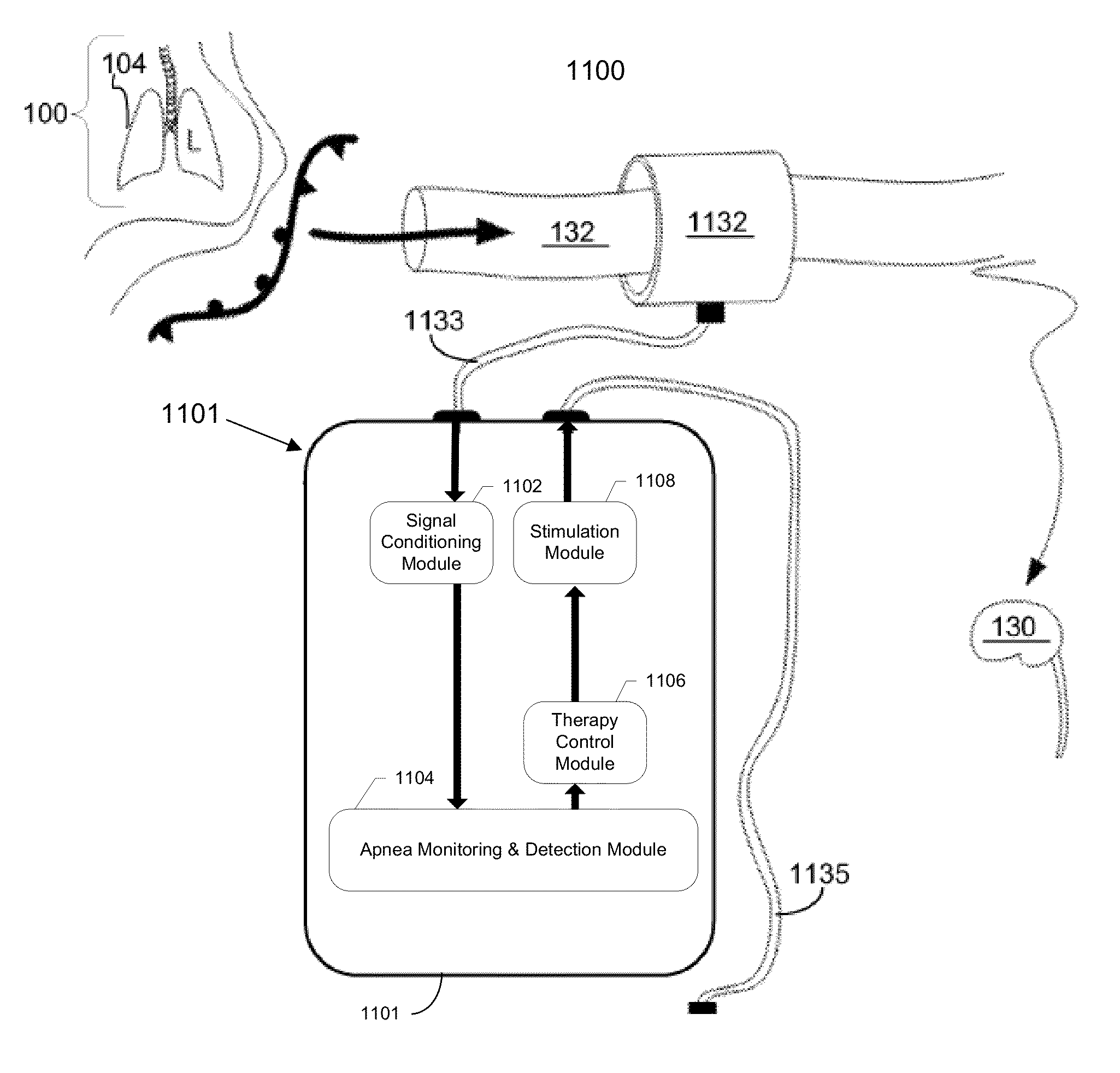 Neuromodulation system and method for treating apnea