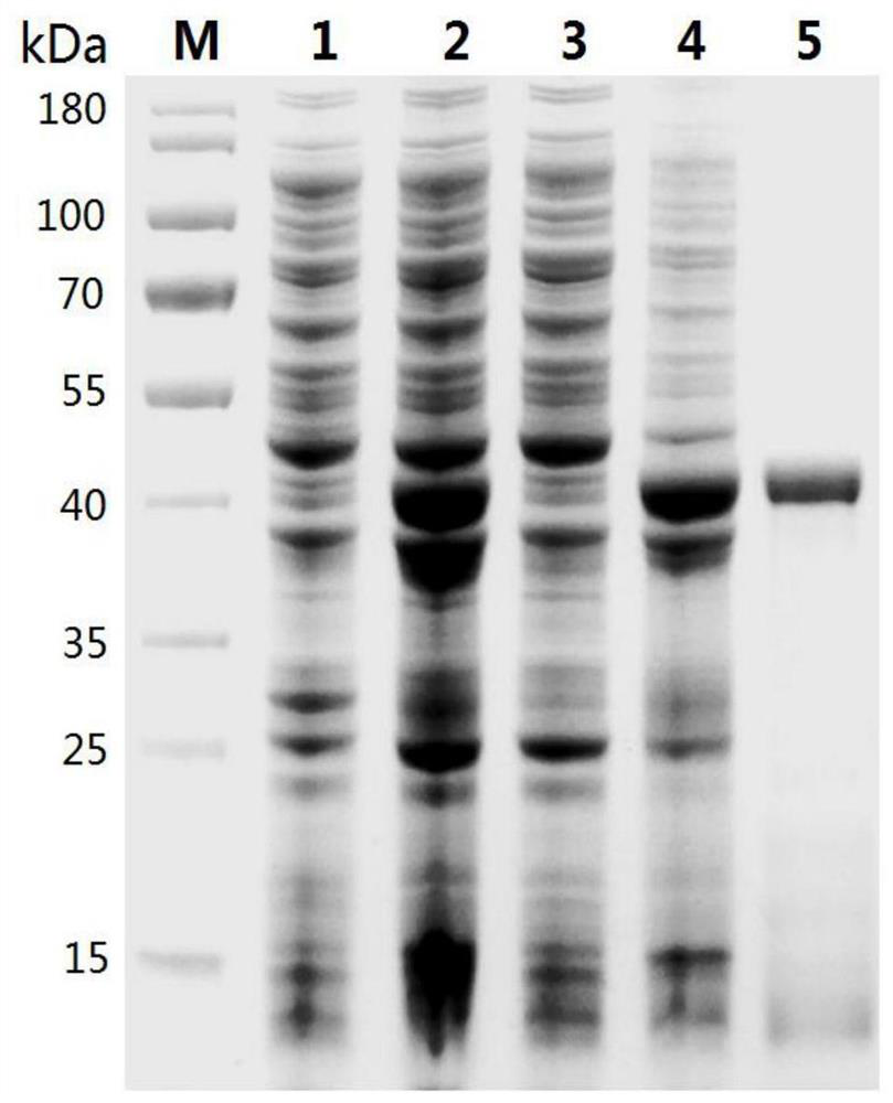 A recombinant fusion protein smsap of Schistosoma mansoni and its application in immunodiagnosis of schistosomiasis