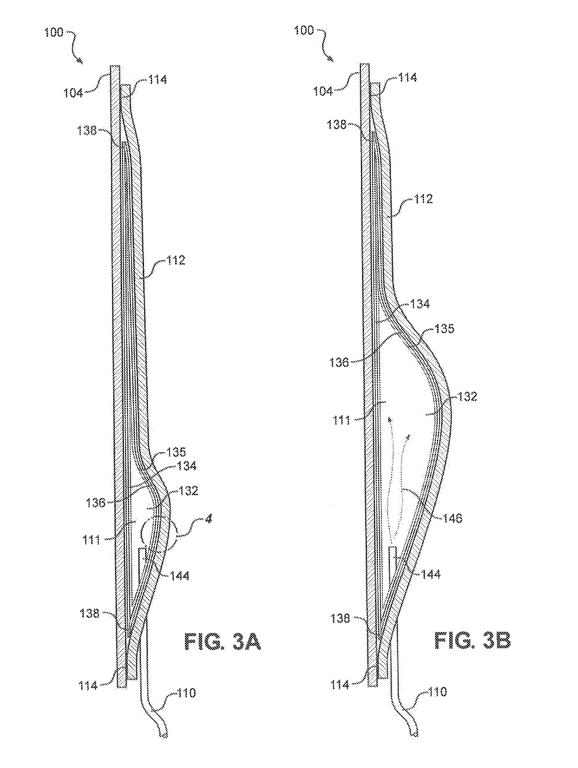 Adhesive Single-Chamber Deep Vein Thrombosis Prevention Garment