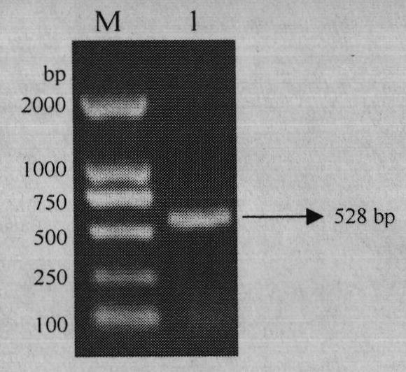 Recombinant lactic acid bacteria of pig interleukin 10 and application thereof