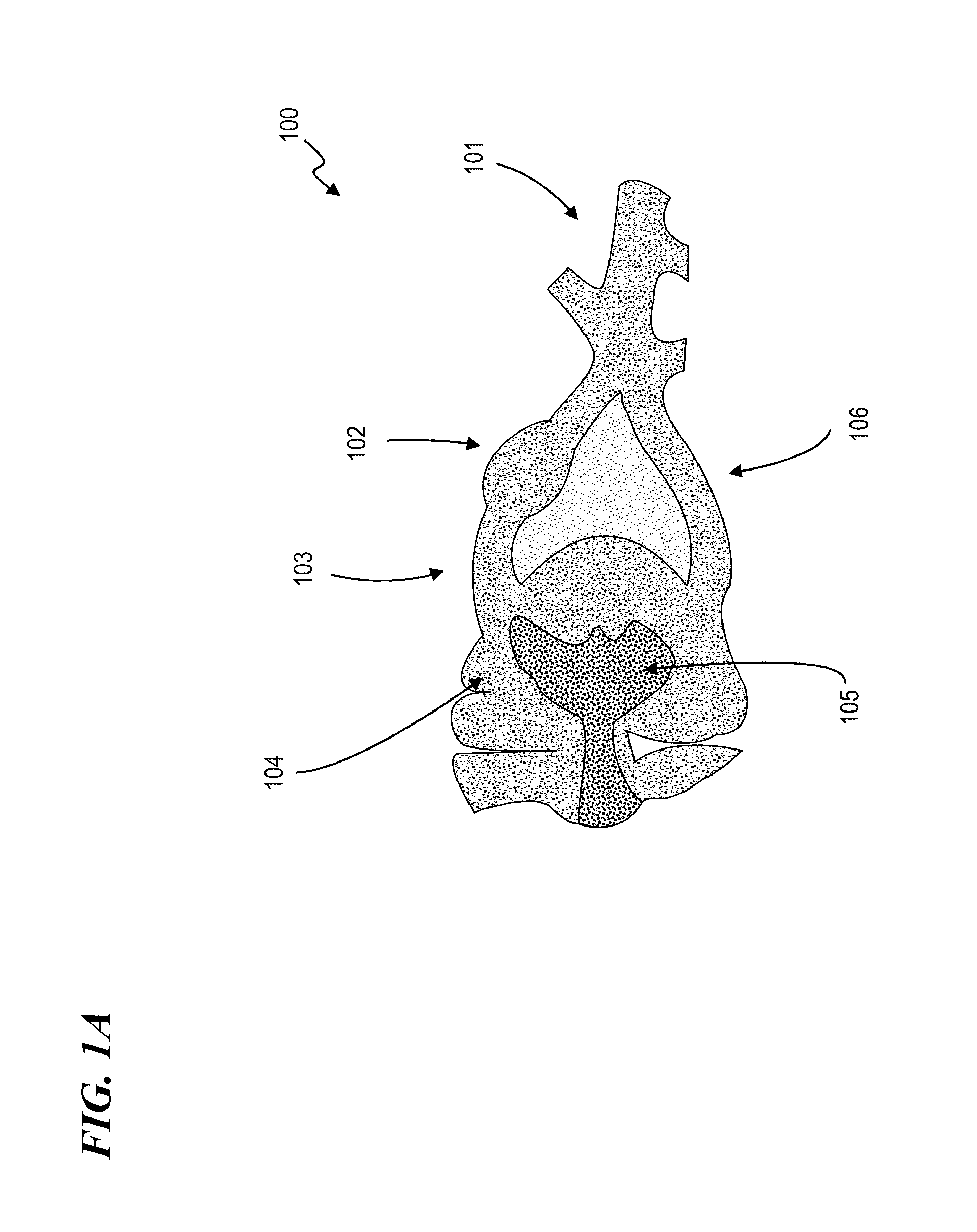 Apparatus and method for managing chronic pain with infrared light sources and heat