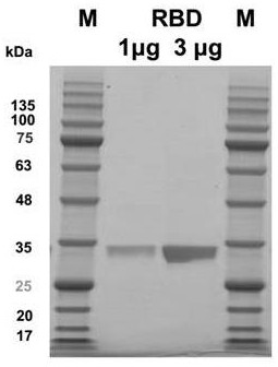 Gene and application of novel coronavirus b.1.525 Nigerian mutant strain rbd