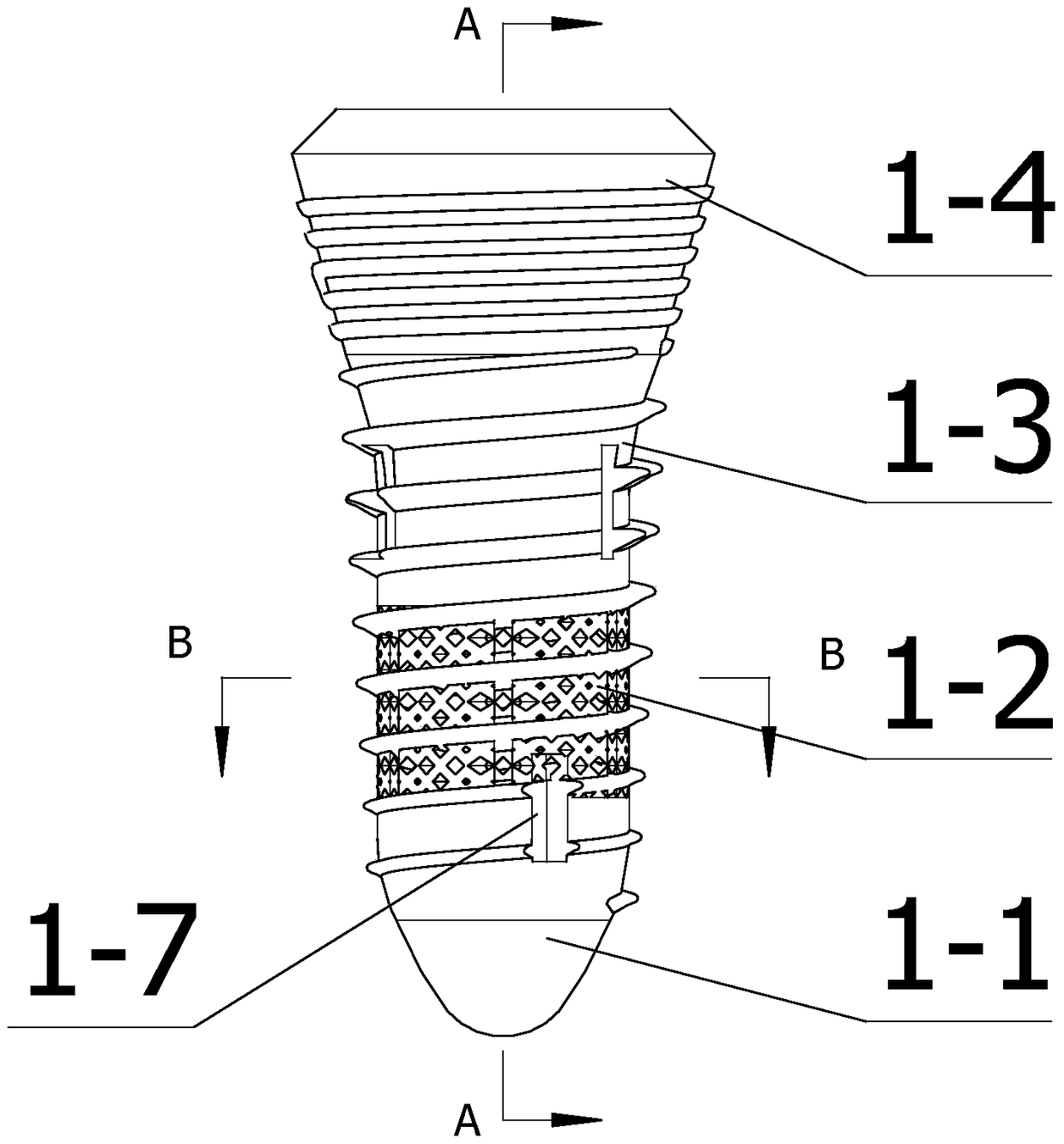 Multi-segment implant components and methods of making the same