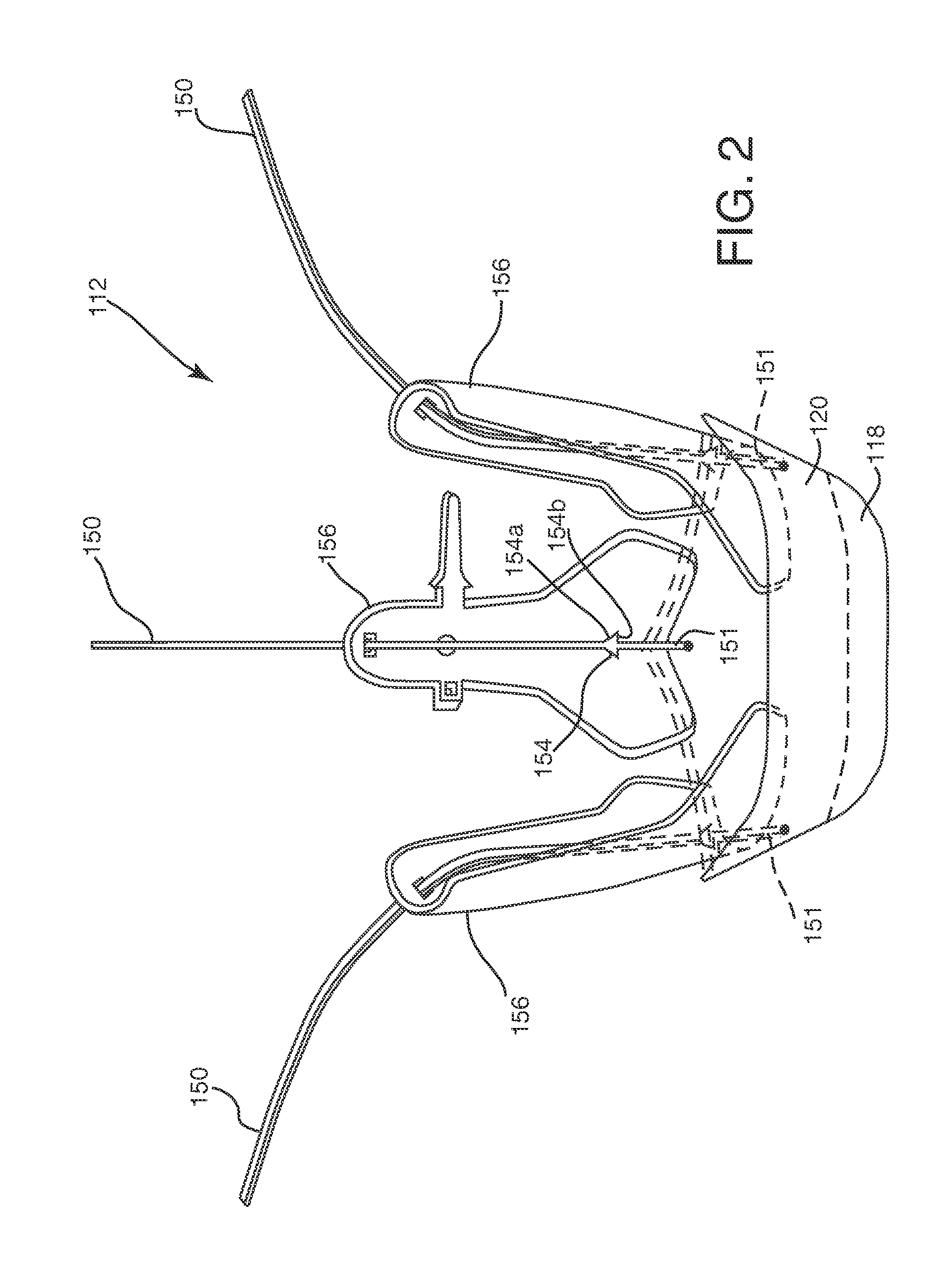 Guide shields for multiple component prosthetic heart valve assemblies and apparatus and methods for using them