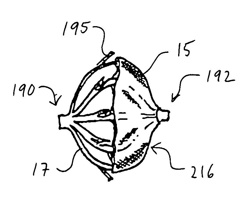Method and device for left atrial appendage occlusion
