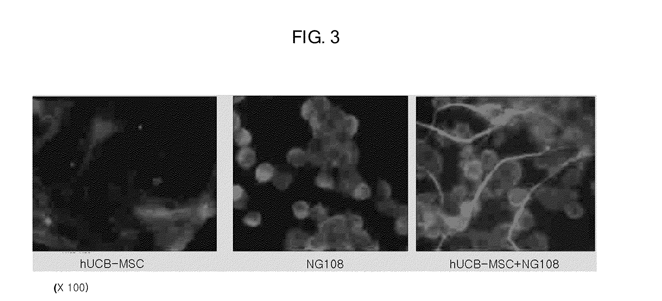 Composition containing human umbilical cord blood-derived mesenchymal stem cell for inducing differentiation and proliferation of neural precursor cells or neural stem cells to neural cells