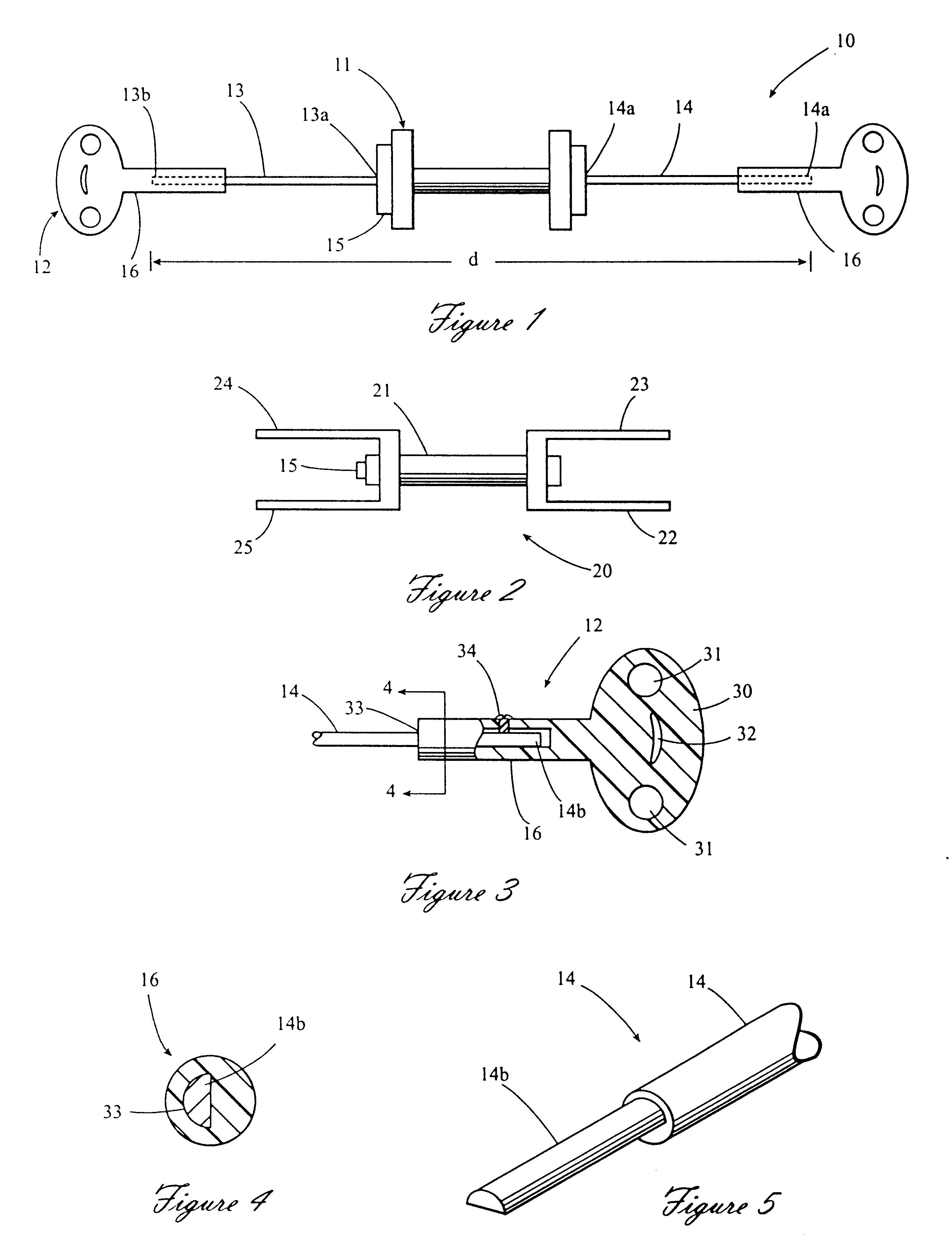 Distraction osteogenesis device and method