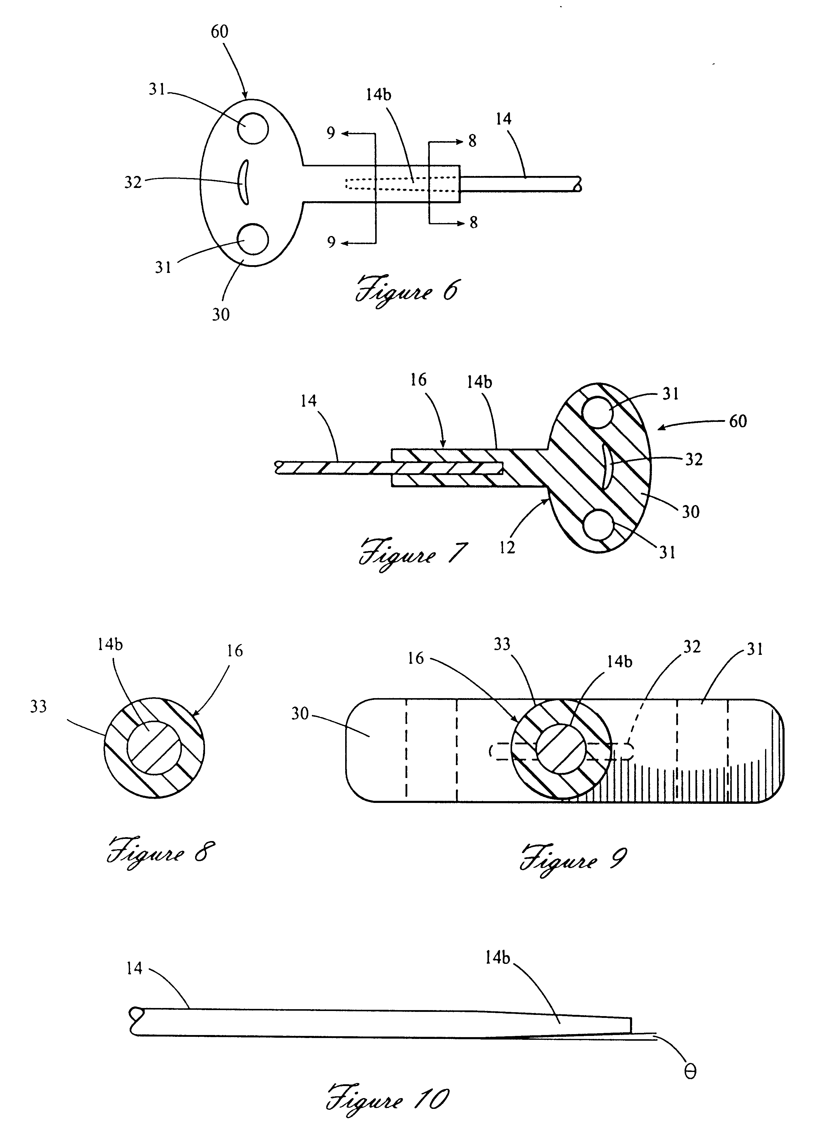 Distraction osteogenesis device and method