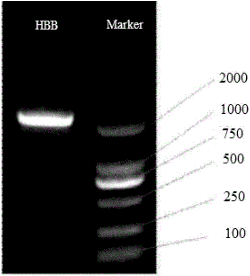 HBB gene kit for correcting autologous hematopoietic stem cell of patient suffering from servious beta-thalassemia