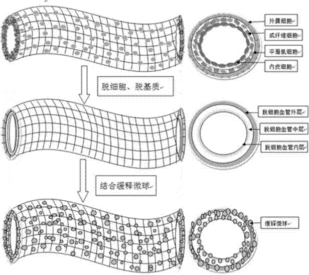 Intelligent tissue engineering blood vessel