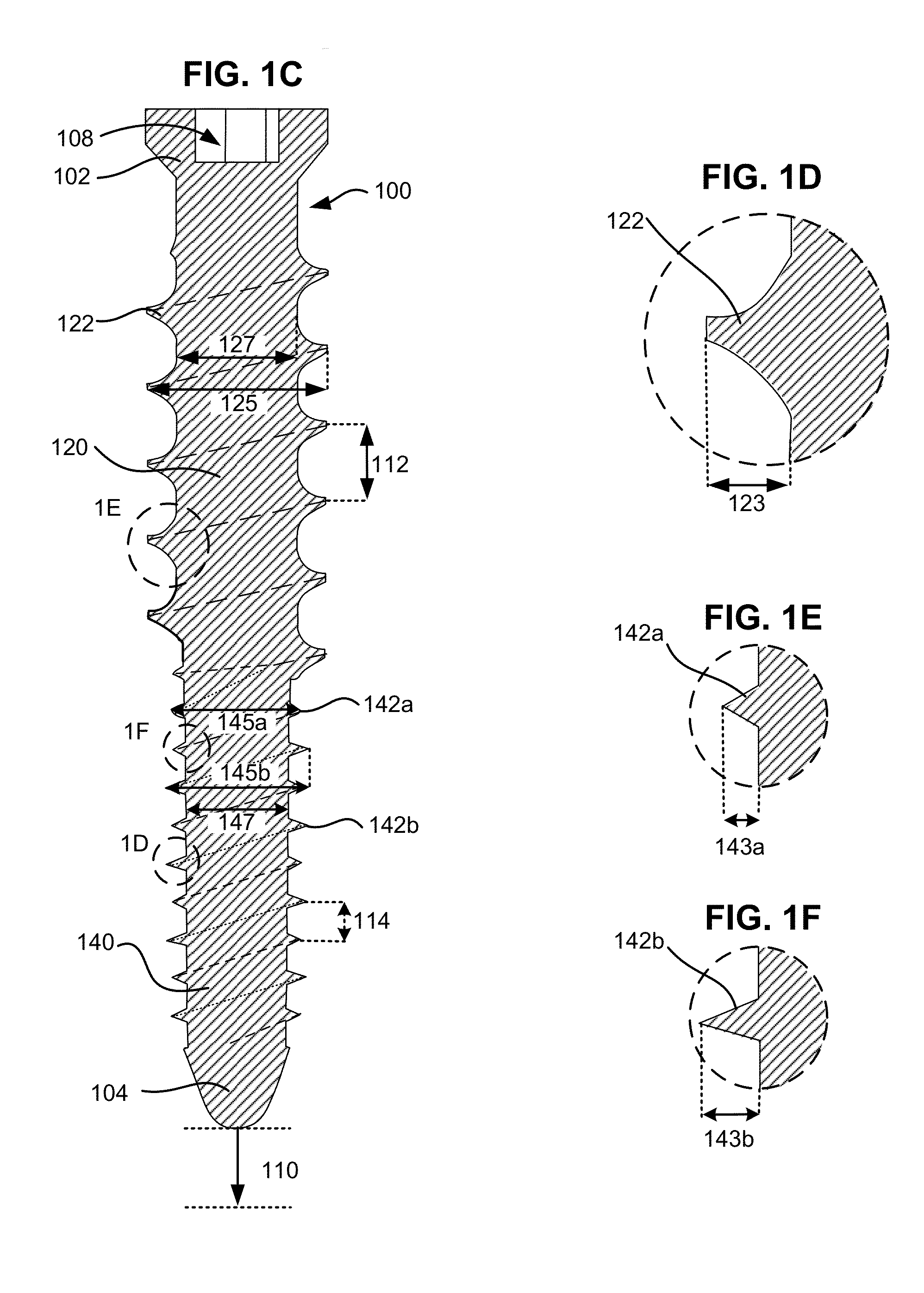 System and method for creating a bore and implanting a bone screw in a vertebra
