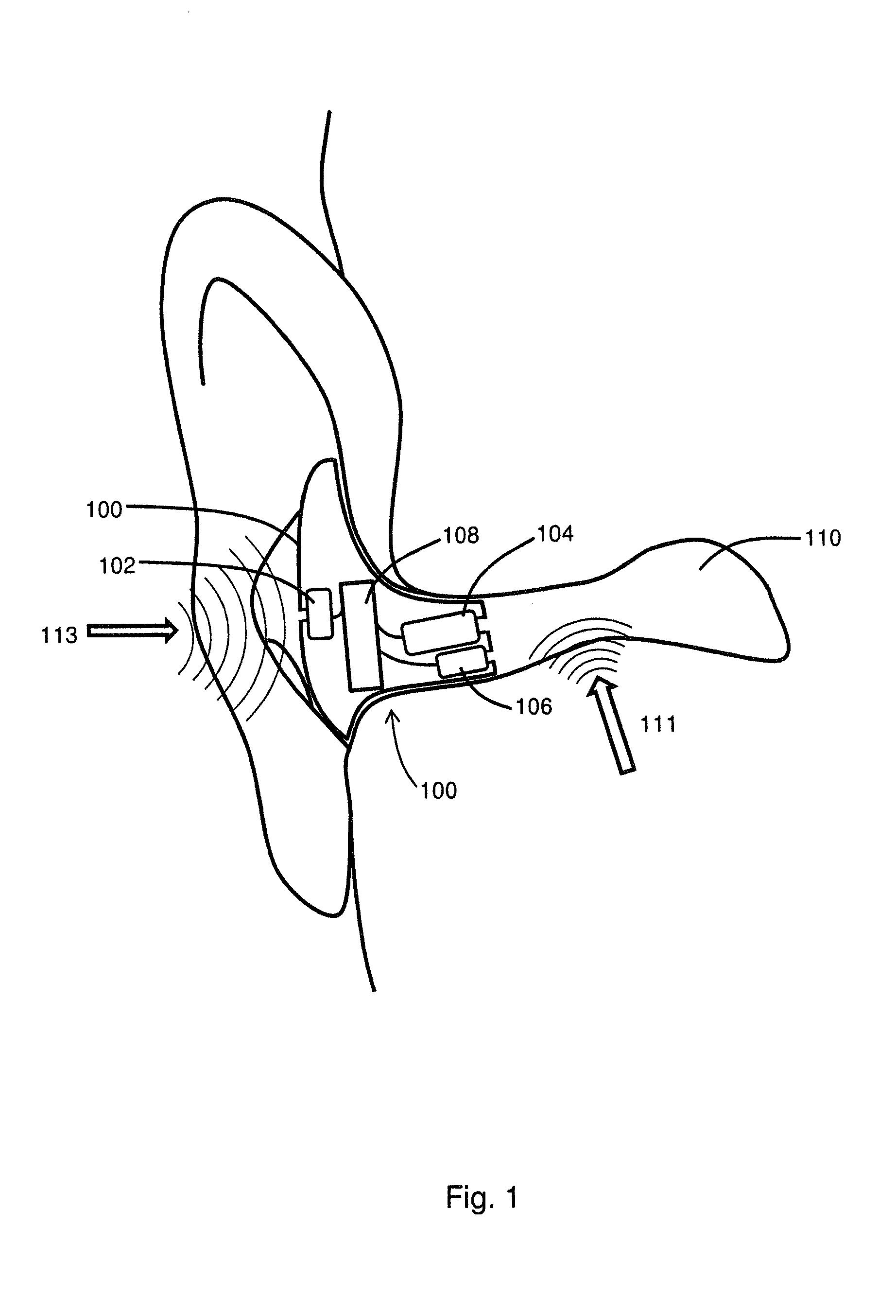 Apparatus and method for digital signal processing with microphones