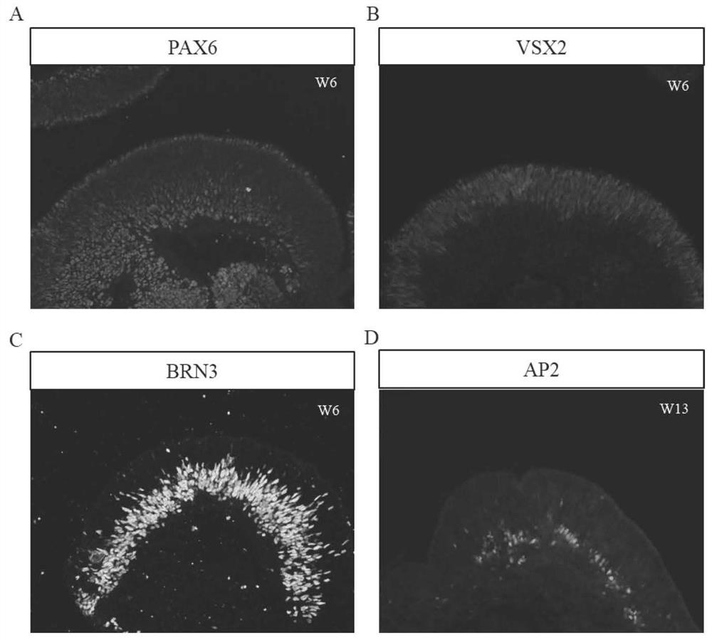 A method for obtaining retinal-like tissue rich in cones and rods by using human induced pluripotent stem cells