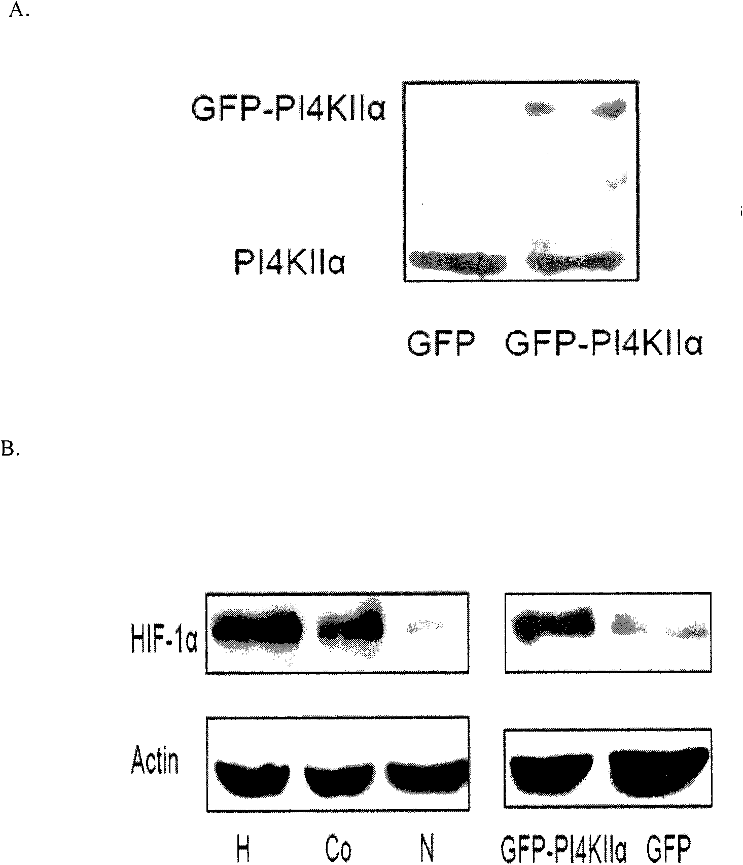 Application of Phosphatidylinositol4-kinase type II alpha PI4KIIalpha