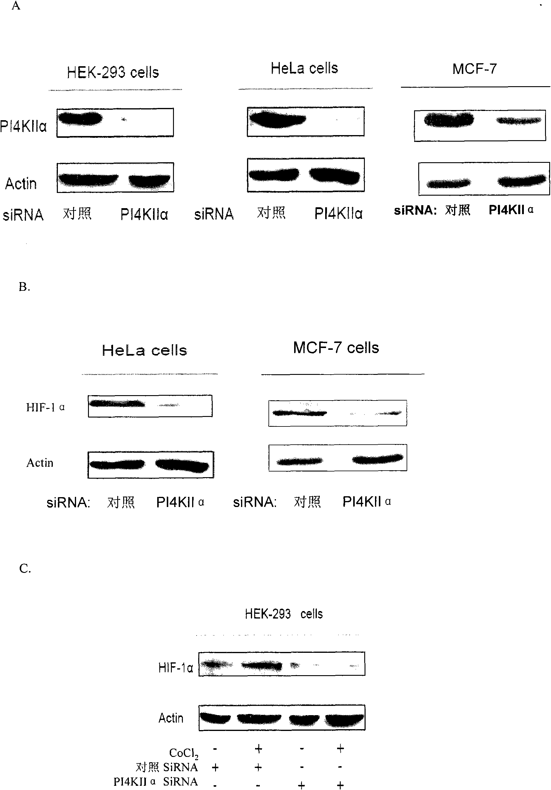 Application of Phosphatidylinositol4-kinase type II alpha PI4KIIalpha