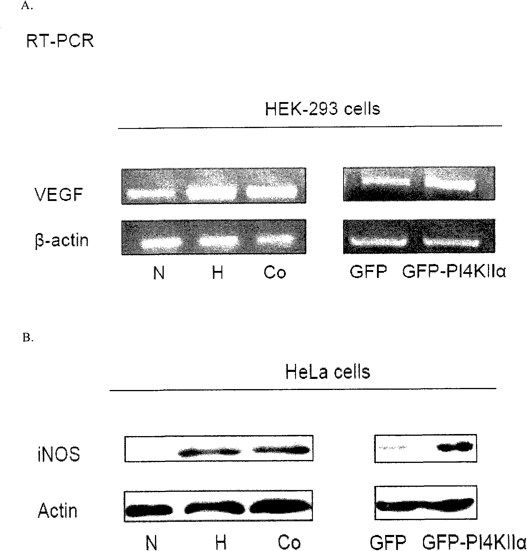 Application of Phosphatidylinositol4-kinase type II alpha PI4KIIalpha