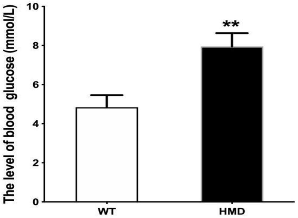 Application of product for detecting TRPC6 gene or expression product thereof