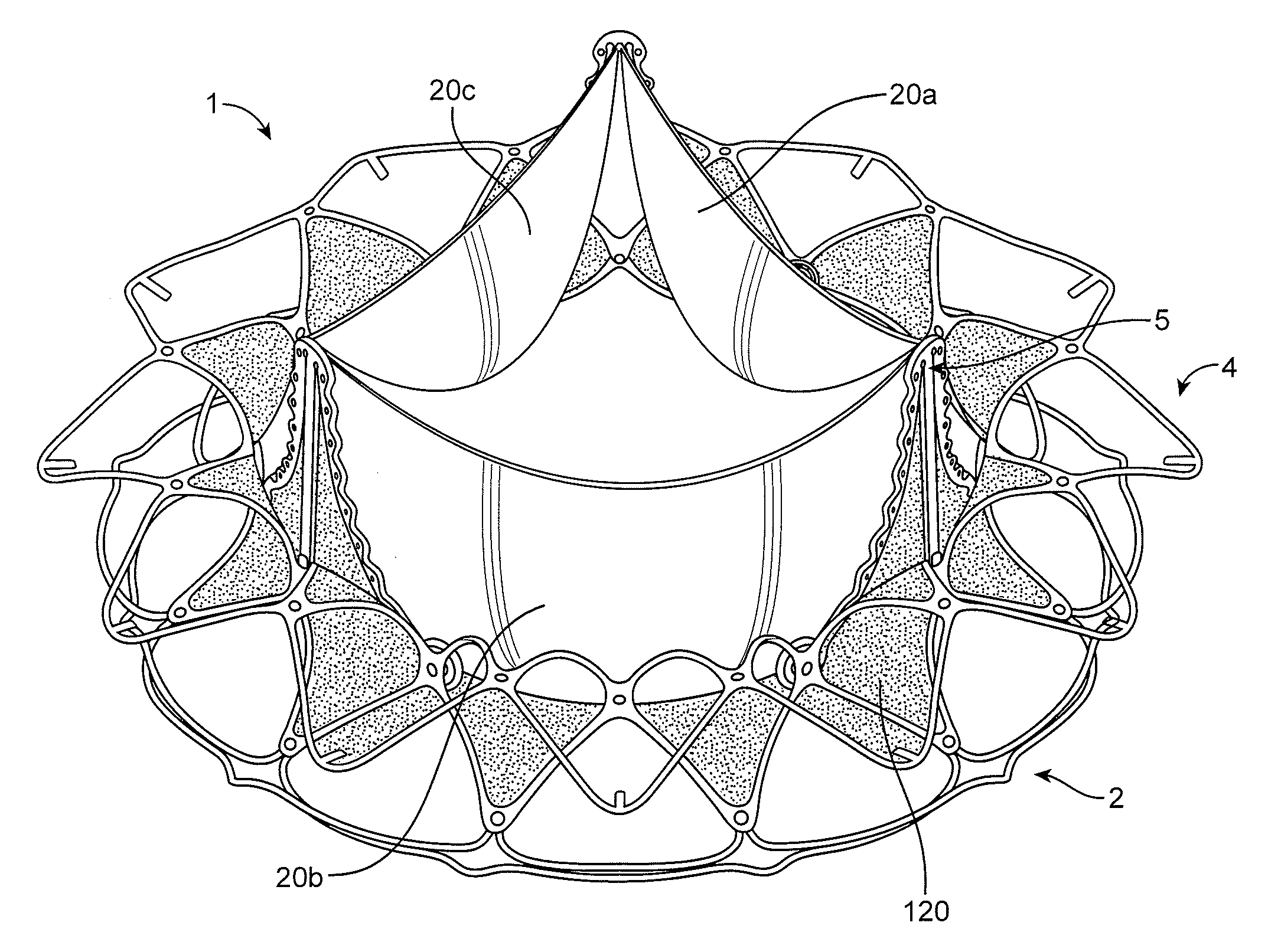 Replacement cardiac valves and methods of use and manufacture