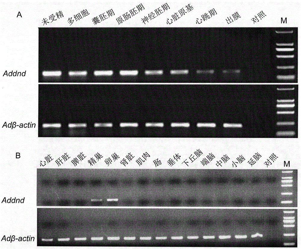 GFP-Addnd 3'UTR recombinant expression vector and constructing method and application thereof