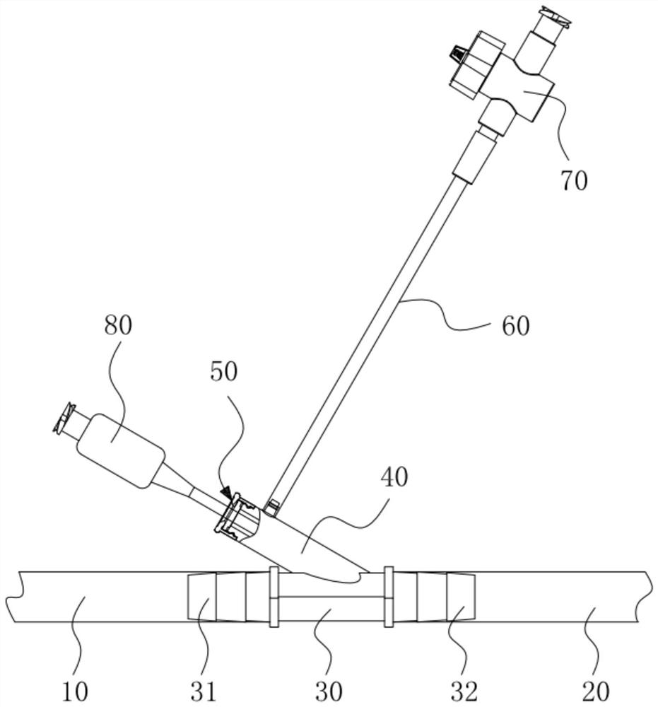 Interventional assistance device