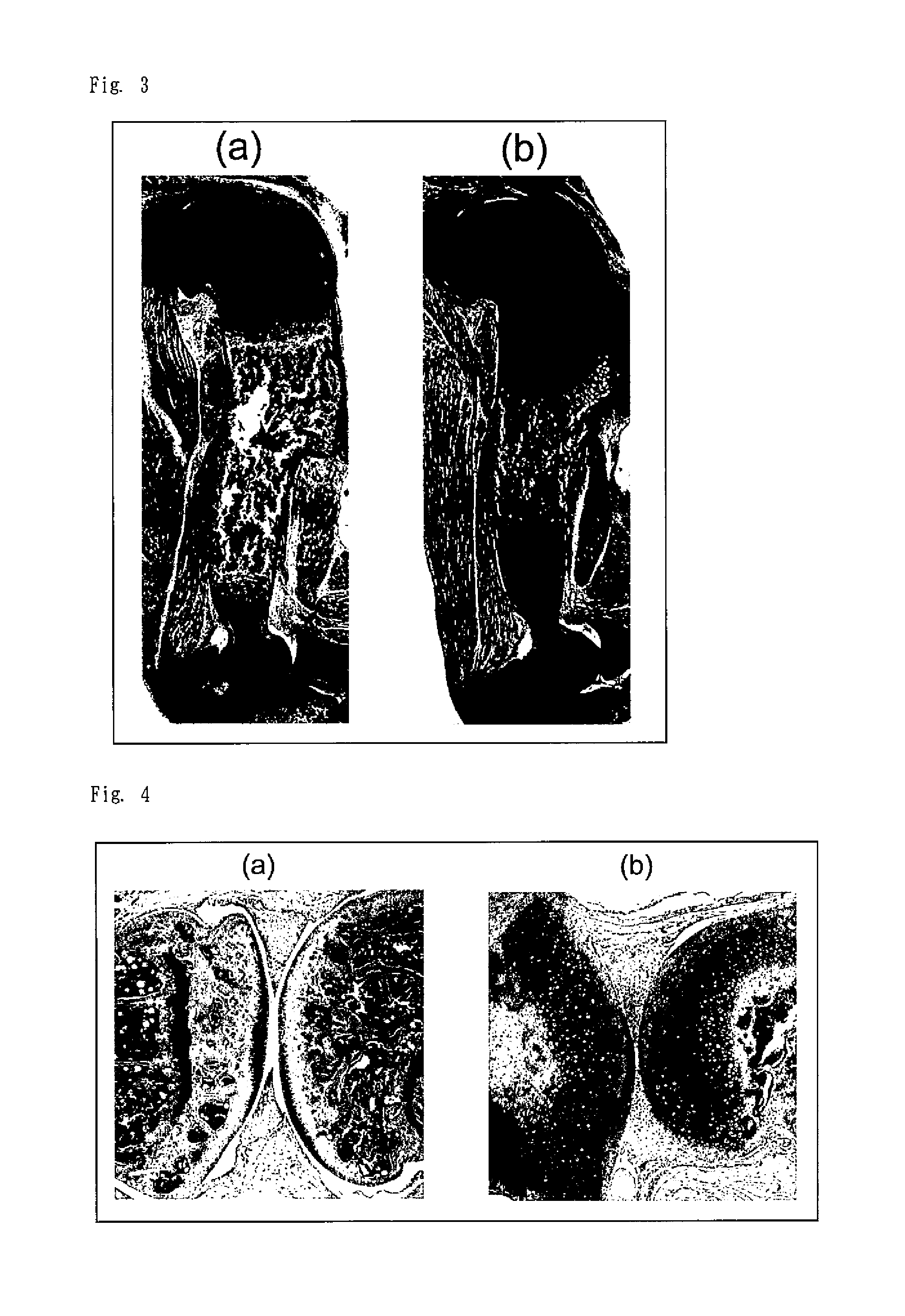 Screening method for therapeutic agent for chondropathy and modified chondrocyte for treatment of chondropathy