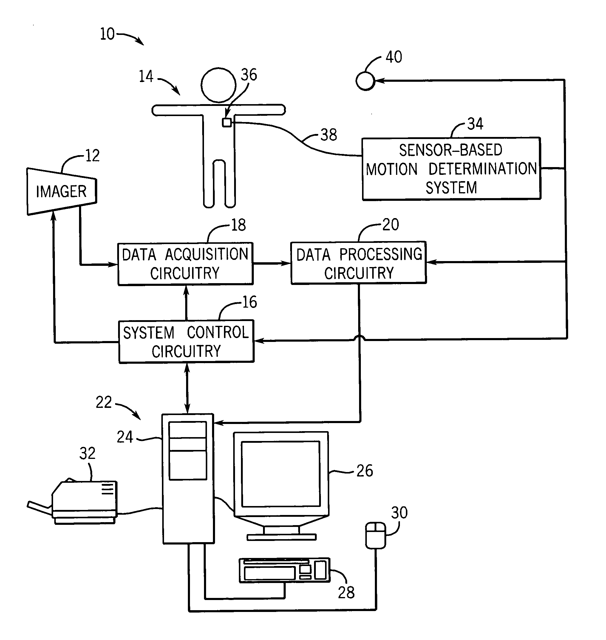 Method and system to reduce motion-related image artifacts during breath holding