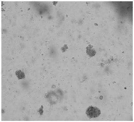 Application of ISL1 in preparation of medicine for inhibiting early ferroptosis of transplanted pancreas islet and cell