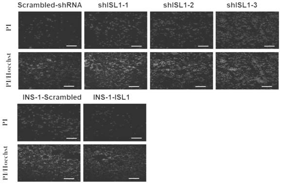 Application of ISL1 in preparation of medicine for inhibiting early ferroptosis of transplanted pancreas islet and cell