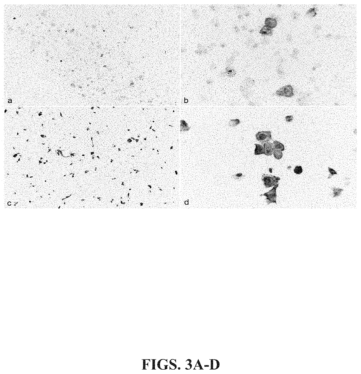 Keratin 17 as a biomarker for bladder cancer