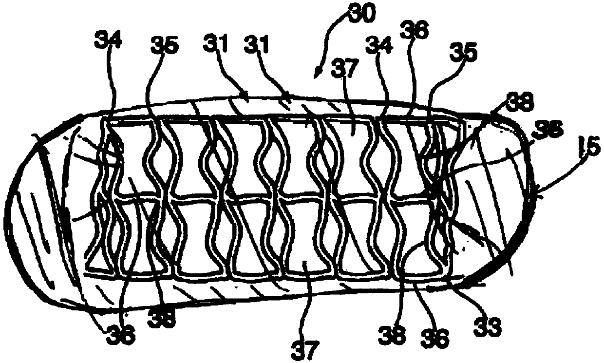 Helical hybrid stent