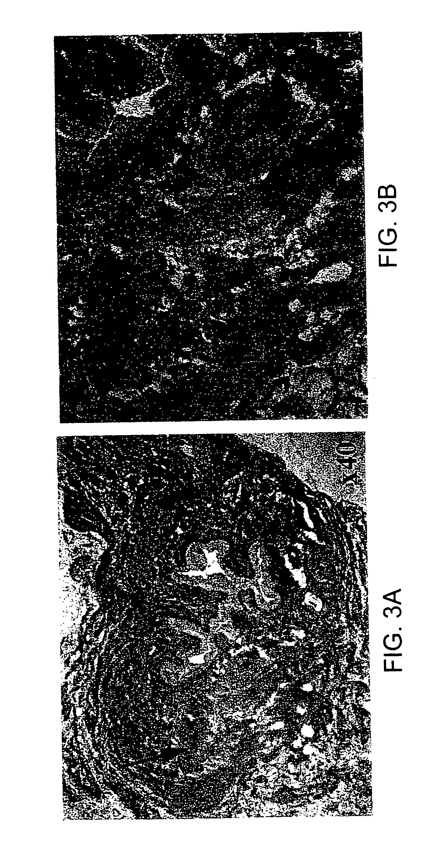 Soft tissue and bone augmentation and bulking utilizing muscle-derived progenitor cells, compositions and treatments thereof
