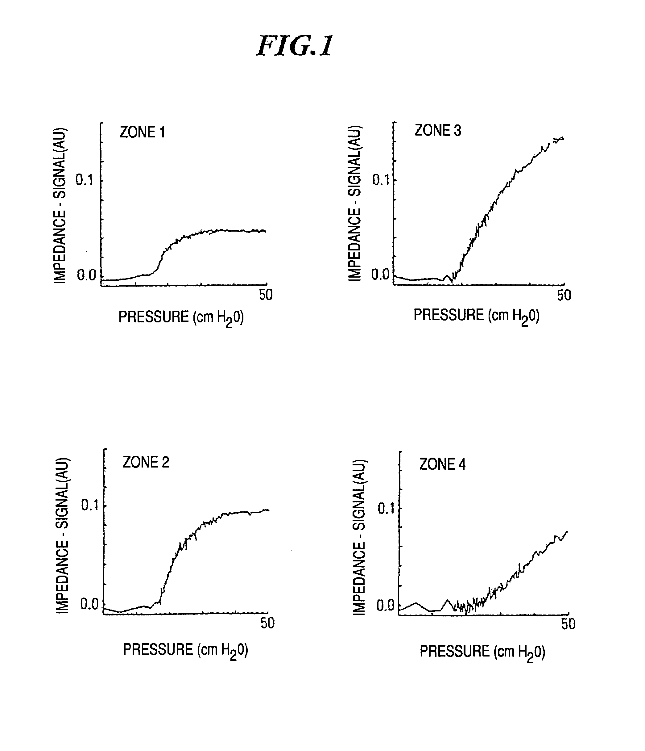 Method and apparatus for determining alveolar opening and closing