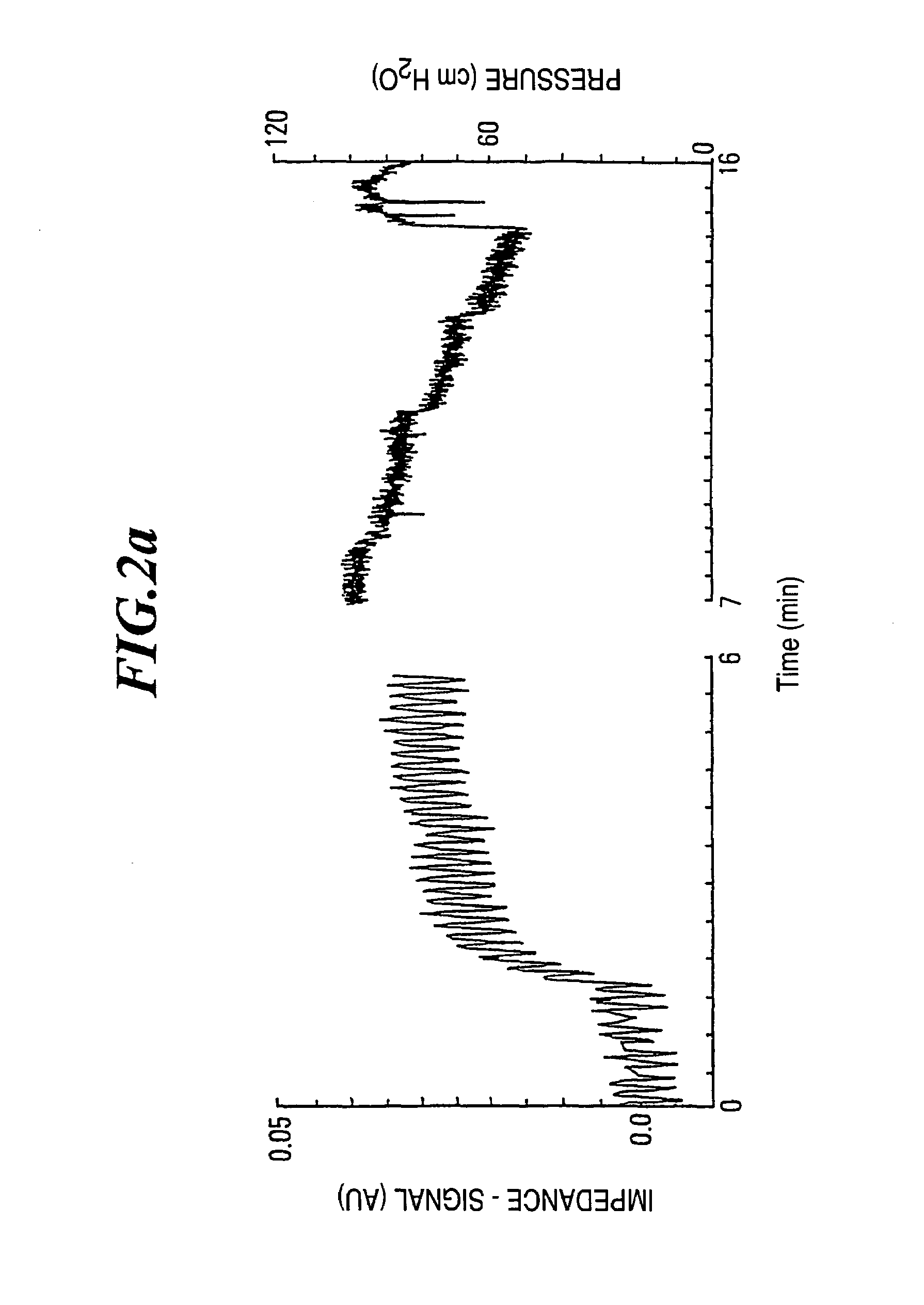 Method and apparatus for determining alveolar opening and closing