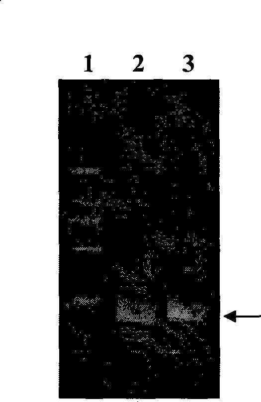 Lung cancer DNA plasmid vaccine and preparation method thereof
