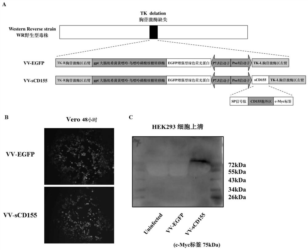 Novel recombinant oncolytic vaccinia virus for blocking immune inspection point and activating immune co-stimulation, construction method for novel recombinant oncolytic vaccinia virus and application of Novel recombinant oncolytic vaccinia virus