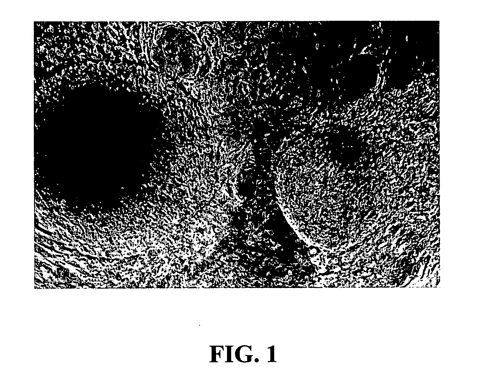 Abscissic acid and derivatives thereof for the treatment of diseases