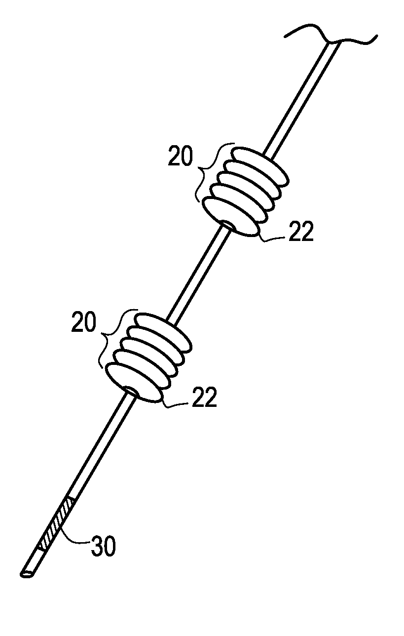 Implantable medical electrical stimulation lead fixation method and apparatus