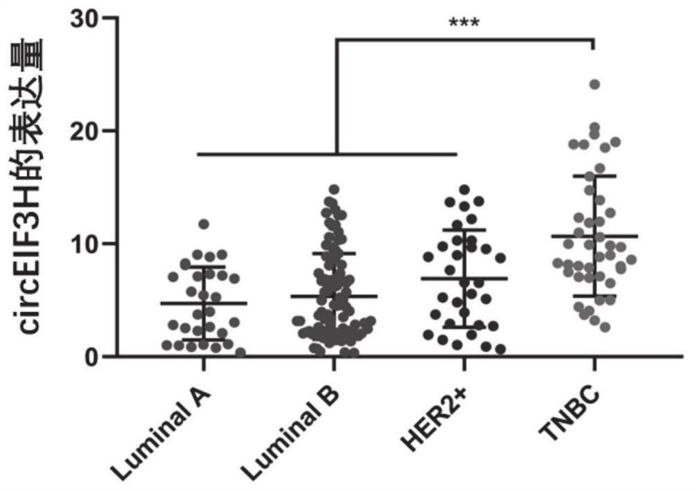 A molecular biomarker for the diagnosis and treatment of triple-negative breast cancer and its application