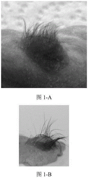 A kind of tissue engineering epidermis and preparation method thereof