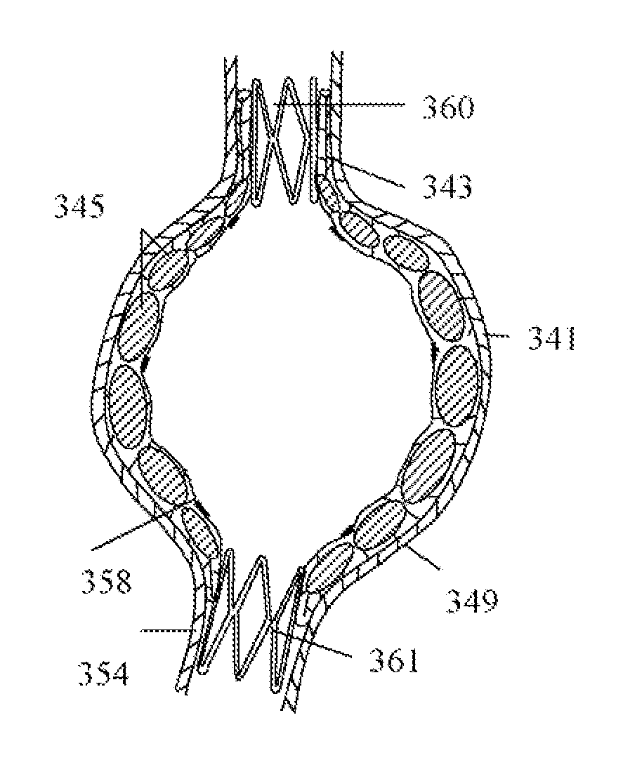 Inflatable devices and methods to protect aneurysmal wall