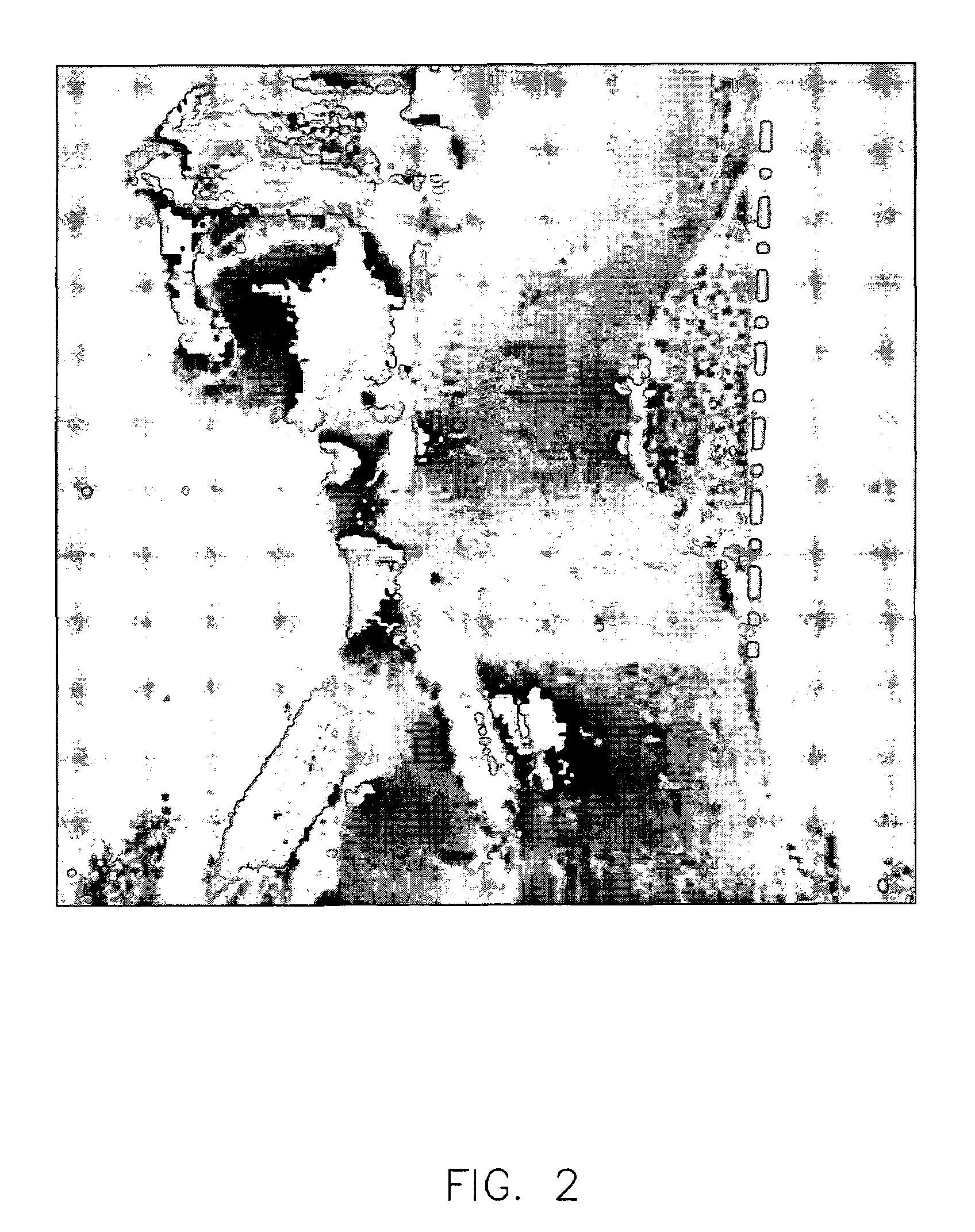 Method and apparatus for enhanced fat saturation during MRI