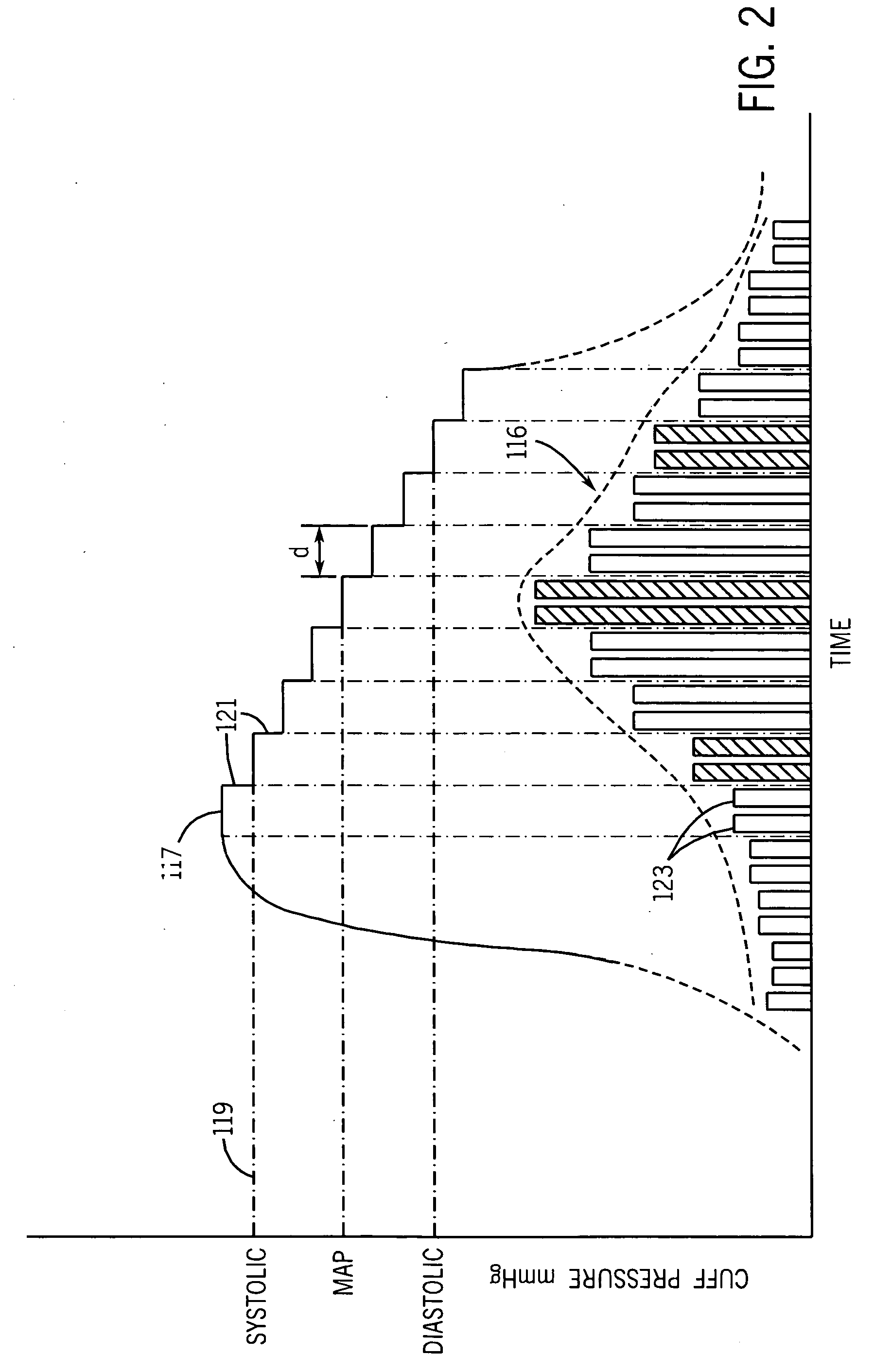 Computation of blood pressure using different signal processing channels