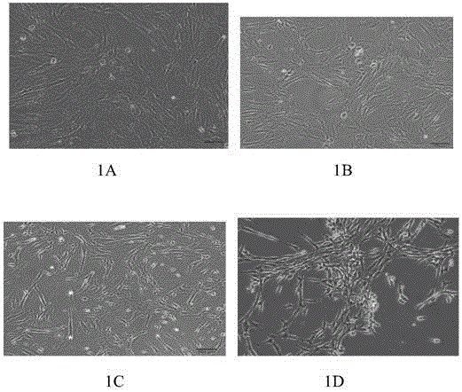 Method for separating and extracting hUC-MSC (human Umbilical Cord mesenchymal stem cells) from wharton jelly tissue of umbilical cord