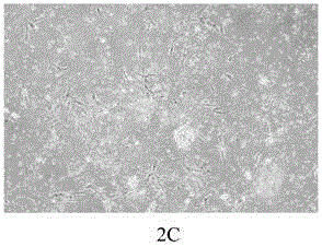 Method for separating and extracting hUC-MSC (human Umbilical Cord mesenchymal stem cells) from wharton jelly tissue of umbilical cord